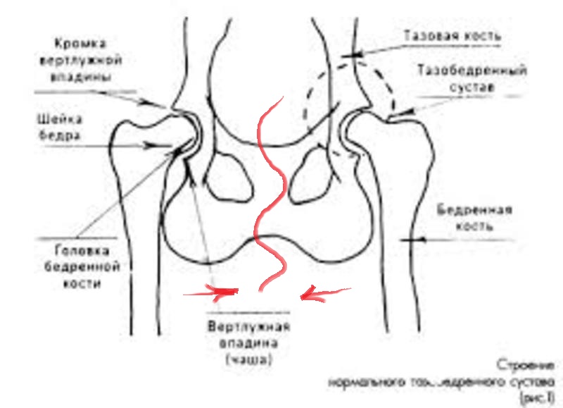 Вертлужная впадина бедра