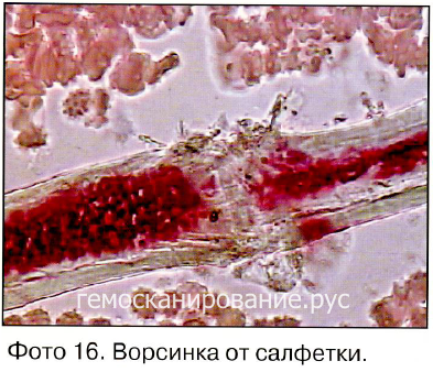 https://s8.hostingkartinok.com/uploads/images/2019/03/deb3b72eb0b4abf25f78350d081a4e49