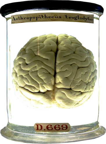 Brain 156